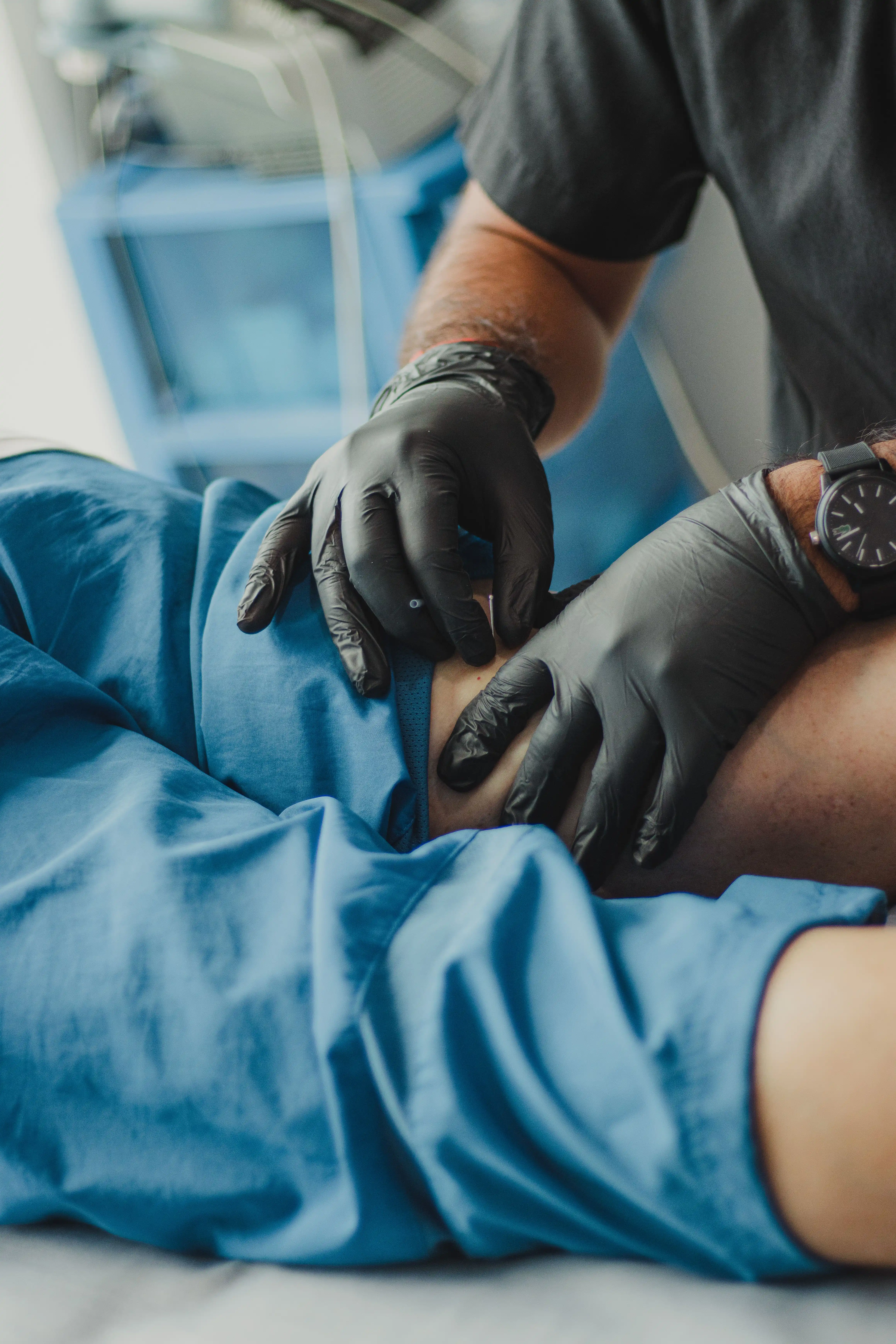 Dry Needling